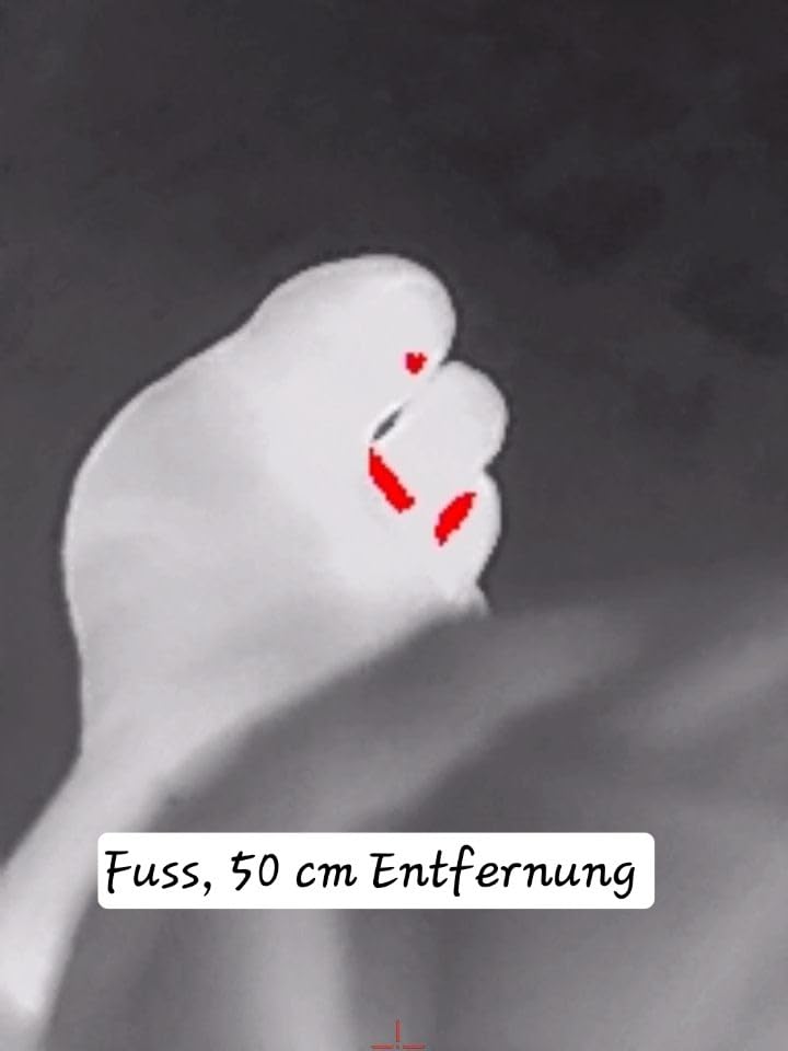 Top Teil